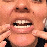Tiras Blanqueadoras Advanced BrightSmile + Corrector de Color
