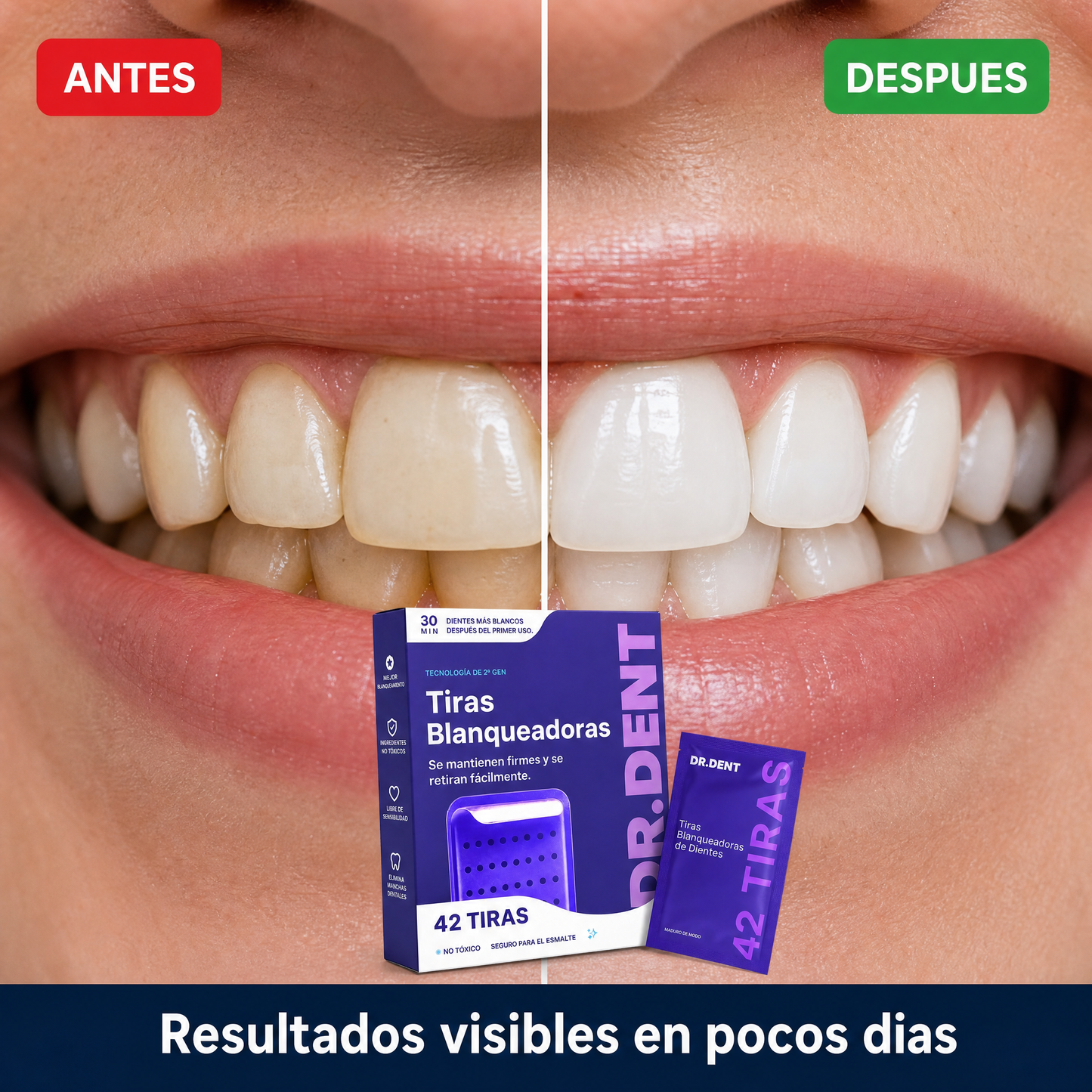 Tiras Blanqueadoras Advanced BrightSmile · Tecnología Morada